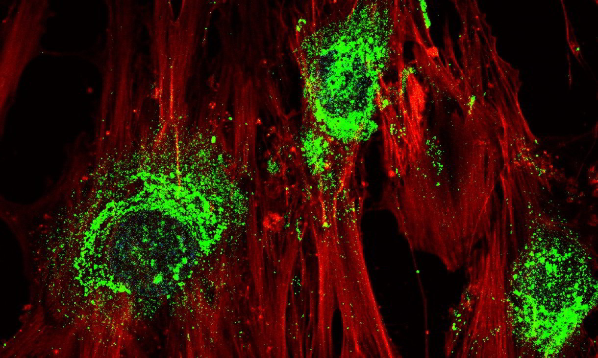 Onde sonore accelerano la crescita del tessuto osseo dalle cellule staminali