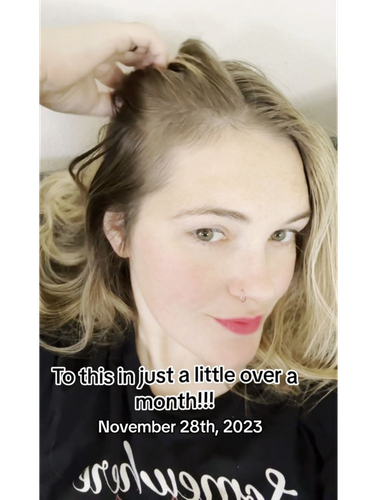 225