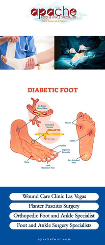 Wound Care Clinic Las Vegas.jpg