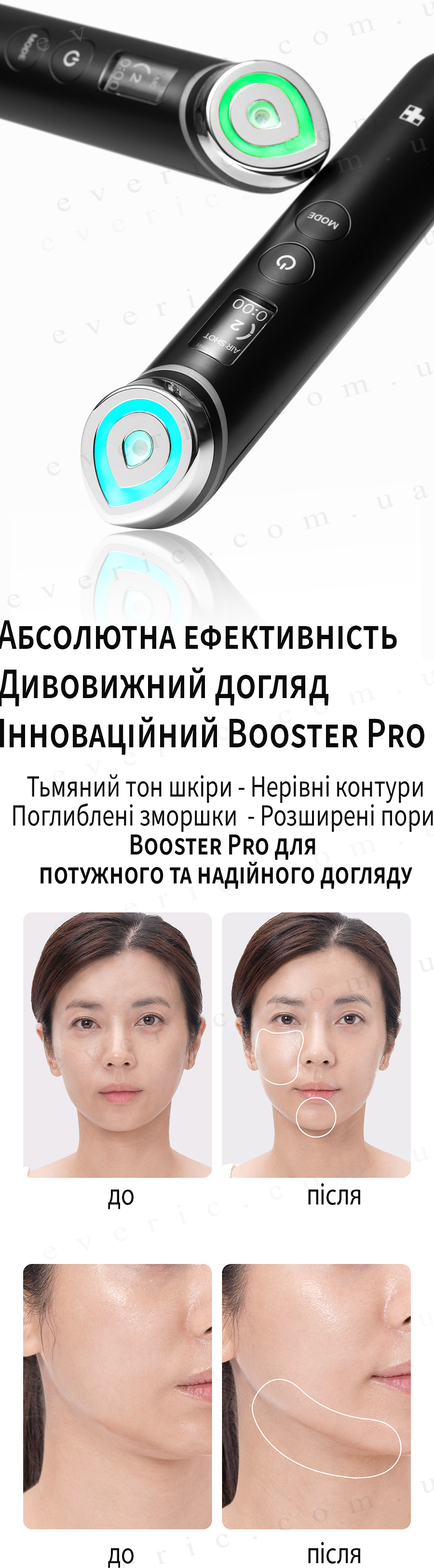 Девайсы Medicube Age R Booster Pro — купить в Украине не дорого в ...