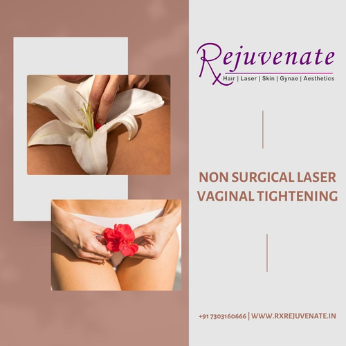 Best Aesthetic clinic in Delhi NCR (24).jpg