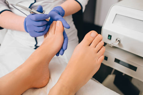 Fungal Foot Infections