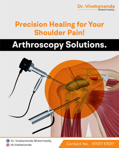 Best Arthroscopic Shoulder Surgeon Hyderabad.jpg
