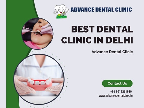 Best Dental Clinic in Delhi for Your Smile.jpg