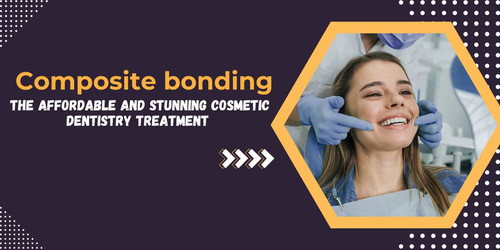 Composite bonding the affordable and stunning cosmetic dentistry treatment.jpg