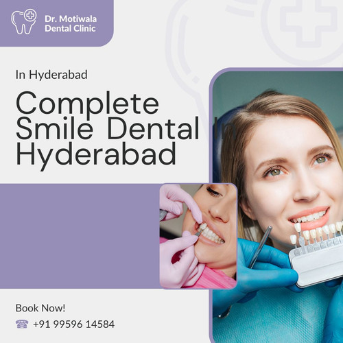 Complete Smile Dental In Hyderabad.jpg