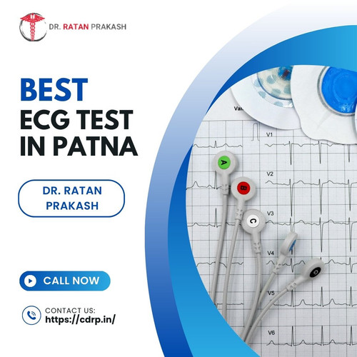 ECG Test in Patna: Dr. Ratan Prakash.jpg