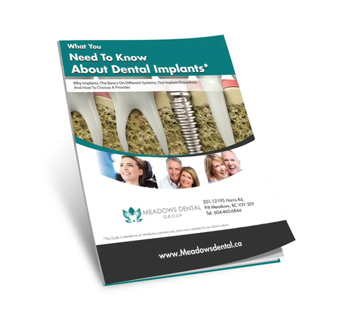 Pitt Meadows dental implants.png