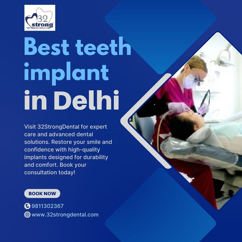 Teeth implant in delhi.jpg