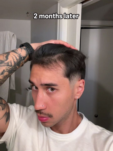 74.png