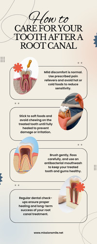 How to Care for Your Tooth After a Root Canal.jpg
