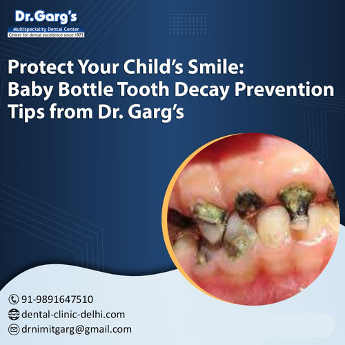 Protect Your Child’s Smile: Baby Bottle Tooth Decay Prevention Tips from Dr. Garg’s.jpg