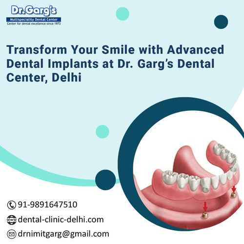 Transform Your Smile with Advanced Dental Implants at Dr. Garg’s Dental Center, Delhi.jpg