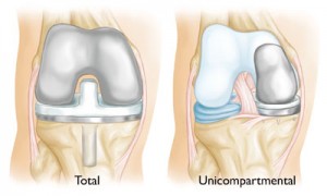 Udai Omni Hospital Expert Knee Replacement & Lung Care in Hyderabad.jpg