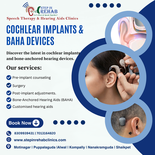 Cochlear implants near me.png