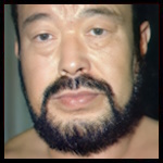 Rusher Kimura 3.jpg