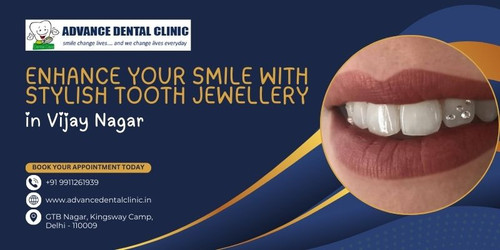 Enhance Your Smile with Stylish Tooth Jewellery in Vijay Nagar.jpg