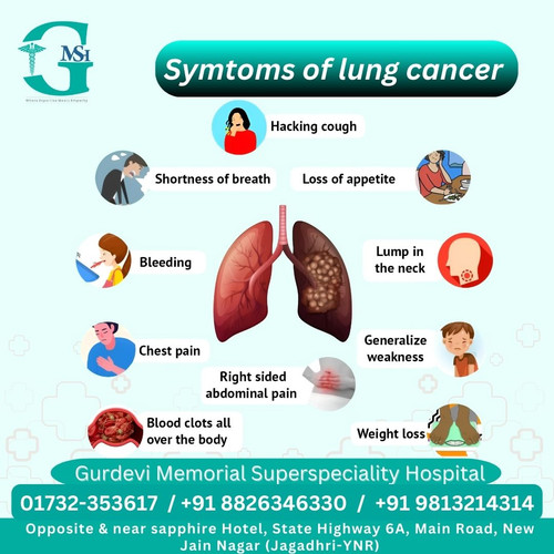Best Lung Cancer Treatment in Yamunanagar at GM Hospital for Reliable Outcomes.jpg