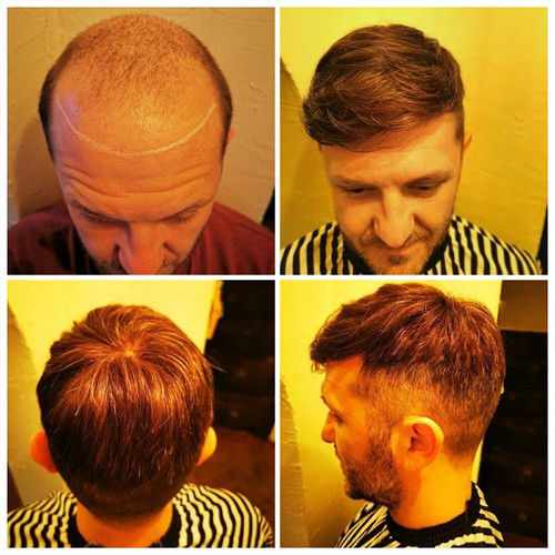 crius-men-s-half-wig-french-lace-in-center-with-polyskin-all-around-must-have-for-traveling (2).jpg
