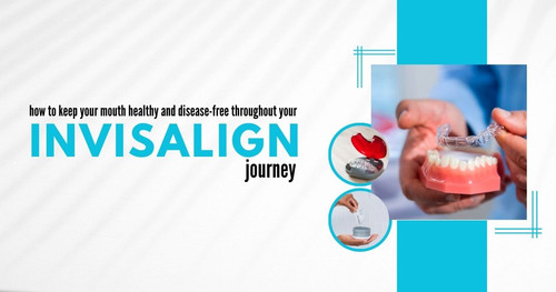 How to keep your mouth healthy and disease free throughout your Invisalign journey.jpg