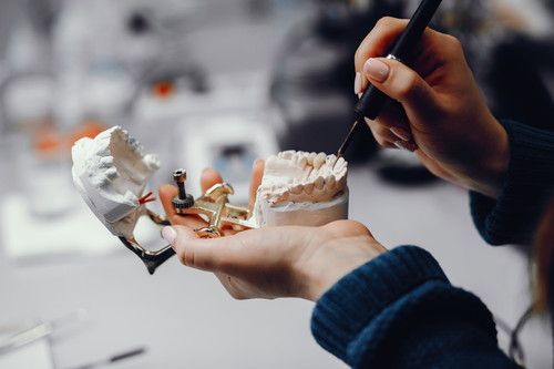 Dental Implants in Auckland.jpg