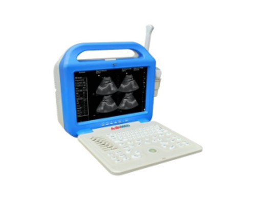Ultrasound Scanner AM US41.jpg