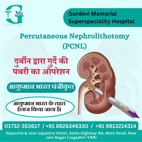 Kidney Stone Treatment in Yamunanagar by the Best Urology Team at GM SuperSpeciality Hospital.jpg