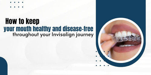How to keep your mouth healthy and disease free throughout your Invisalign journey.jpg