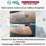 Laser Tattoo Removal in Siddipet
