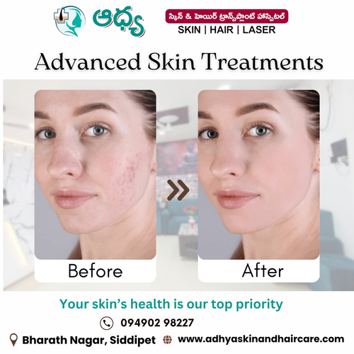 Best Skin Specialist in Siddipet