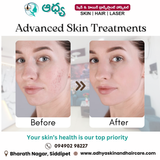 Best Skin Specialist in Siddipet