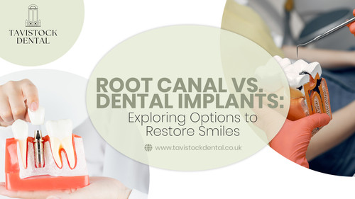 Root Canal Vs. Dental Implants.jpg
