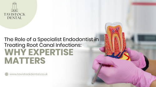 The Role of a Specialist Endodontist in Treating Root Canal Infections.jpg
