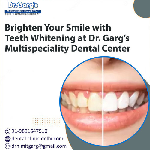 Brighten Your Smile with Teeth Whitening at Dr. Garg’s Multispeciality Dental Center.jpg