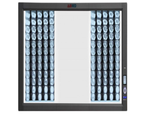 Ultra Slim X RAY Film Viewer AM ULX RAYA12T.jpg
