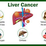 liver2513
