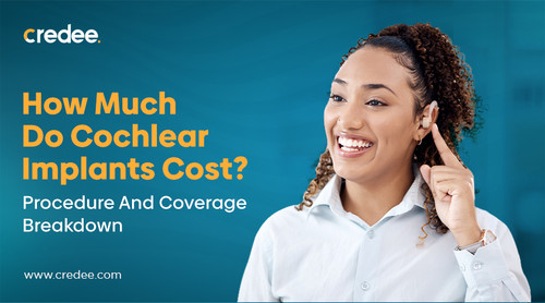 How Much Do Cochlear Implants Cost.jpg