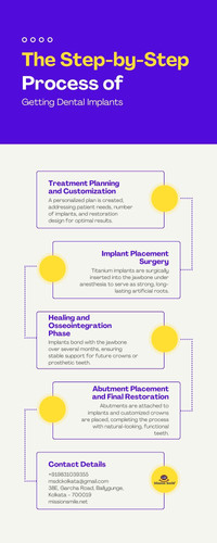 The Step-by-Step Process of Getting Dental Implants.jpg