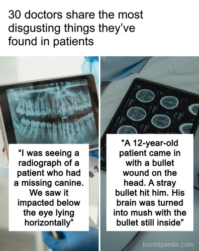 craziest thing found in patient.jpg