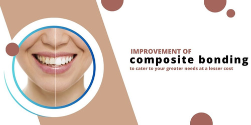 Improvement of composite bonding to cater to your greater needs at a lesser cost.jpg