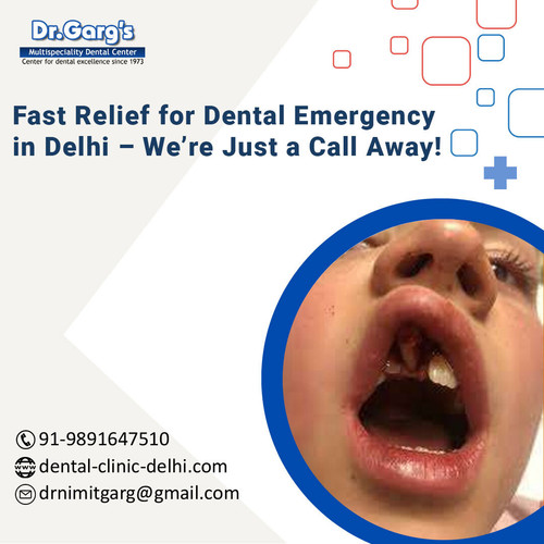 Fast Relief for Dental Emergency in Delhi – We’re Just a Call Away!.jpg