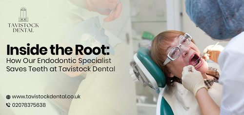 How Our Endodontic Specialist Saves Teeth at Tavistock Dental.jpg