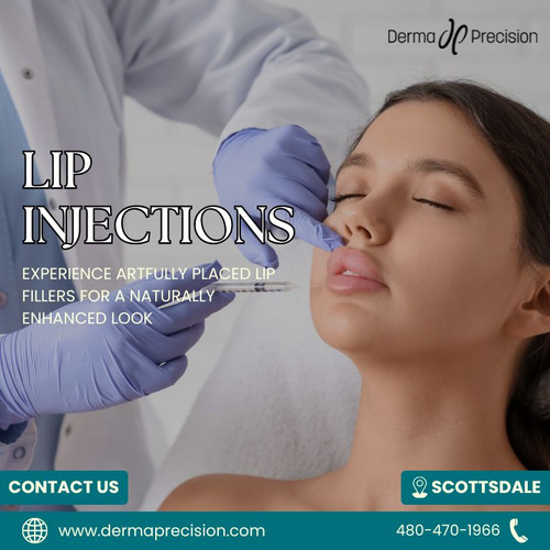Lip Injections in Scottsdale.jpg