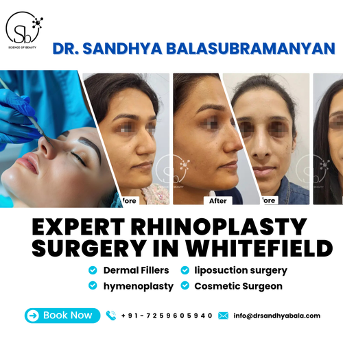 Get The Perfect Nose with Expert Rhinoplasty Surgery in Whitefield.png