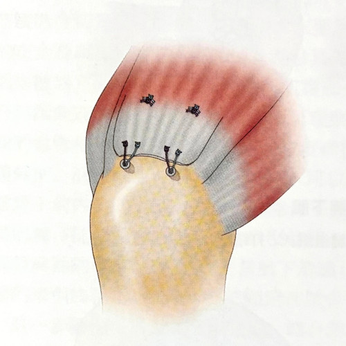 mmexport1743377086505.jpg