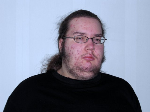 acne nerd gamer.jpg