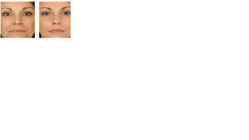 skin image.png