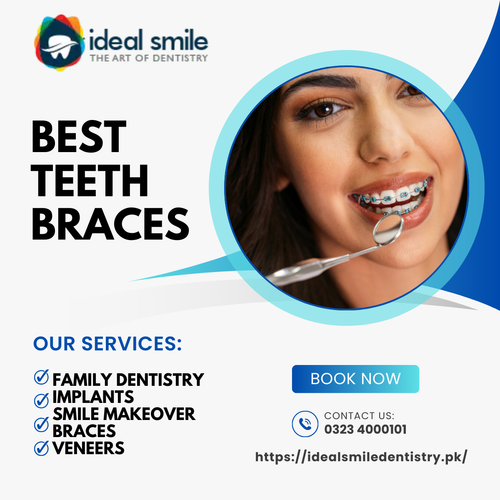 teeth braces.png