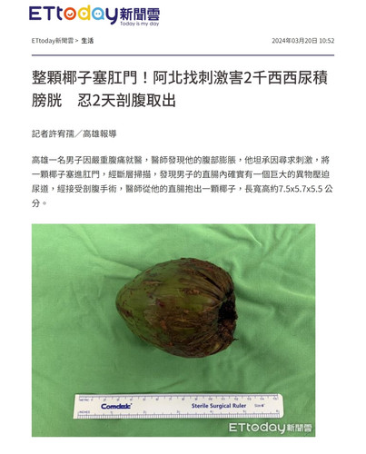 患者坦承2天前將椰子塞進肛門口【ETtoday】short.jpg