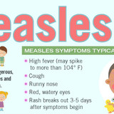 measles2503